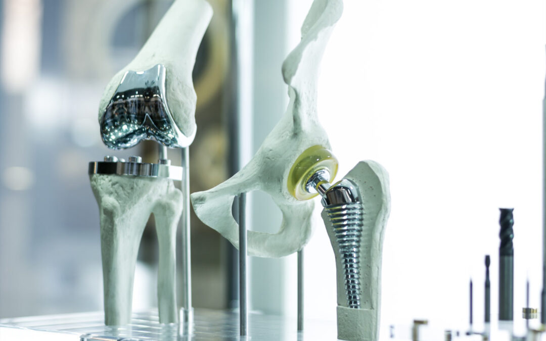 Common Causes Leading to Joint Replacement